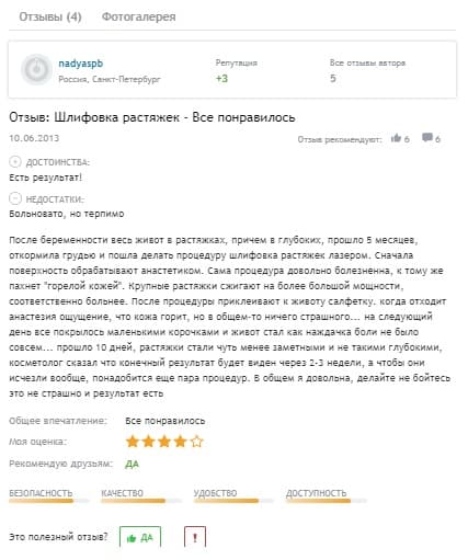 Лазерное удаление растяжек_отзывы