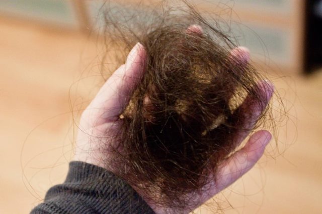 Почему начинается выпадение волос после коронавируса