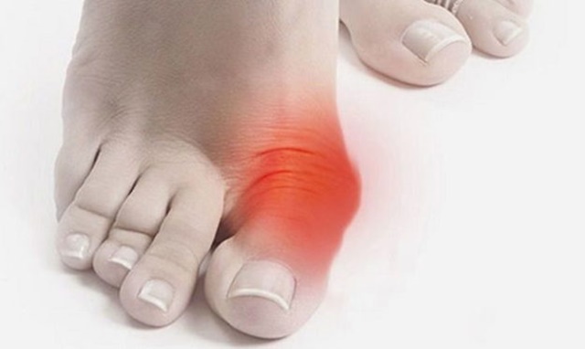 Причины появления болей в косточке на большом пальце ноги
